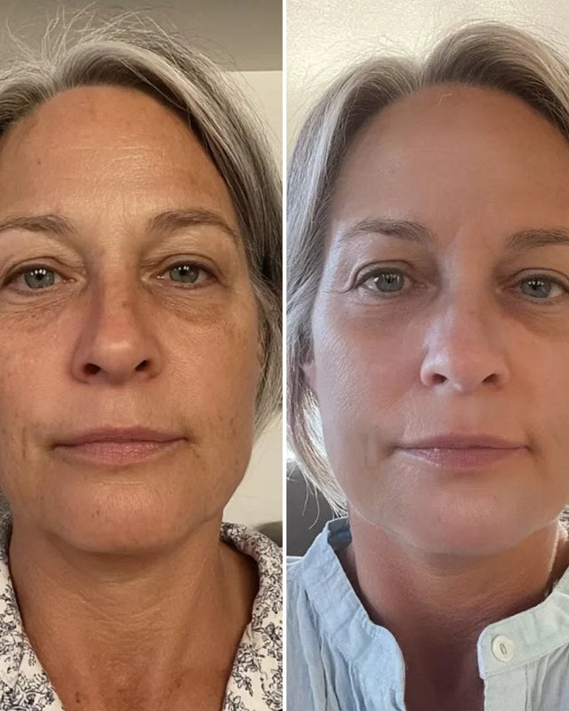 Antes e depois do rosto de frente de uma cliente de cabelo grisalho