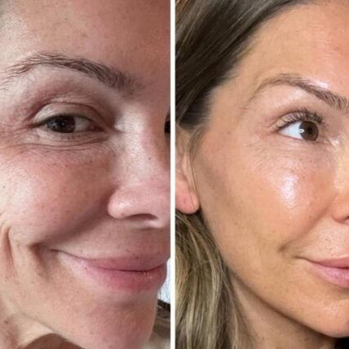 Antes e depois de Fernanda Q.
