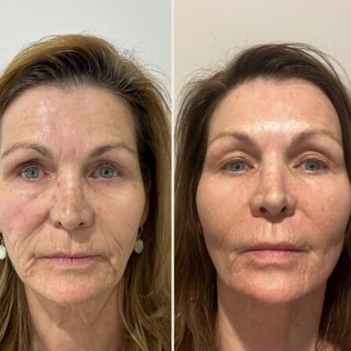 Antes e depois de Larissa C.