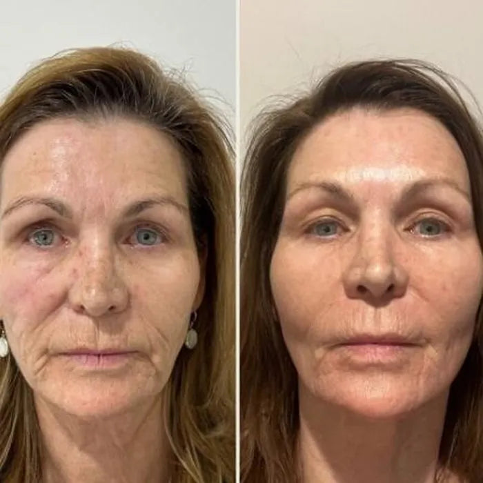 Antes e depois de Larissa C.