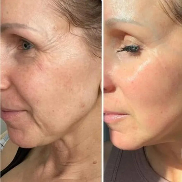Antes e depois de Lorena A.